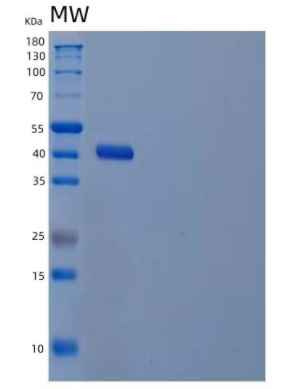 Recombinant Human UDP-Glucose 4-Epimerase/GALE Protein(N-6His)