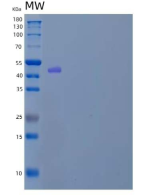 Recombinant Mouse Serpin D1/Heparin Cofactor II/HCF2 Protein(C-6His)