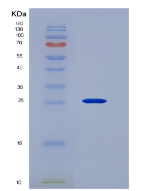 Recombinant Cluster Of Differentiation 40 Ligand (CD40L).