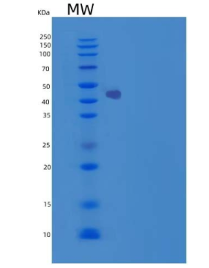 Recombinant Human Carbonic Anhydrase IX / CA9 Protein (His tag)