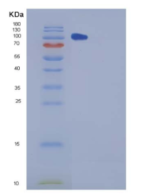 Recombinant Mouse CHL-1 Protein