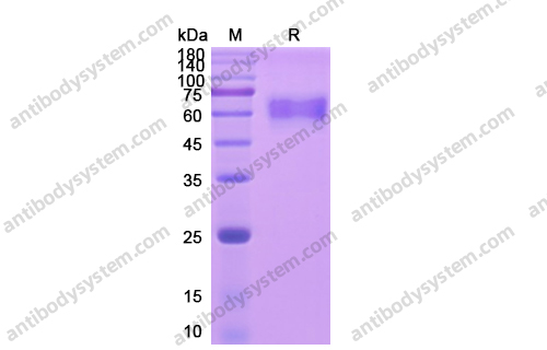 Recombinant Human CD126/IL6R/IL-6RA, C-His