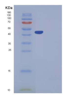 Recombinant Mouse Serpinb6b Protein (His tag)