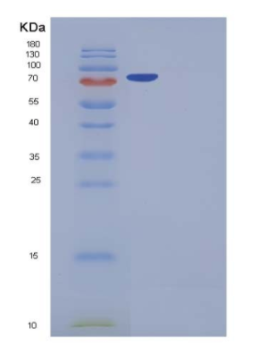 Recombinant Human DNMT2 / TRDMT1 Protein (GST tag)