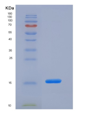 Recombinant Mouse MOG (aa30-149) Protein (His tag)