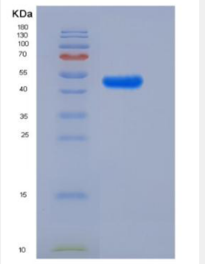 Recombinant Human LILRA5/CD85 Protein (Fc Tag)