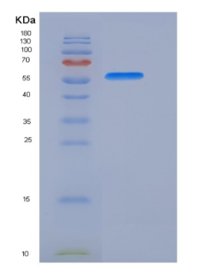 Recombinant Human AKT1 / PKB / PKBα Protein (His tag)