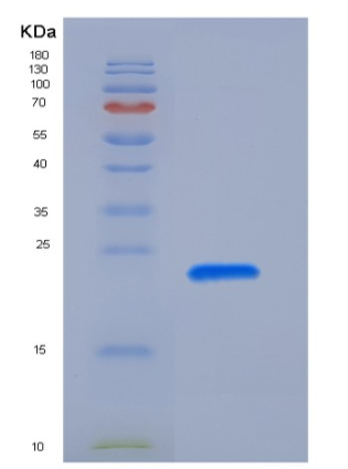 Recombinant Rat PRL2A1 / Prolactin-2A1 Protein (His Tag)