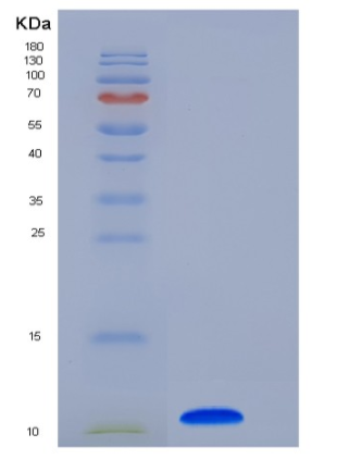 Recombinant Human COL6A3 / Collagen-VI Protein (His tag)