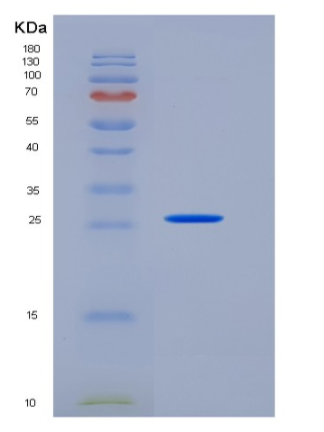 Recombinant Human Carbonic Anhydrase X / CA10 Protein