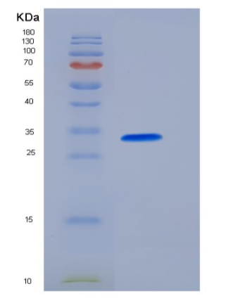 Recombinant Human Carbonic Anhydrase VII / CA7 Protein (His tag)
