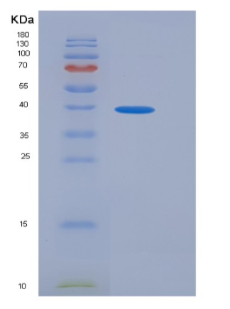 Recombinant Human CAMK4 / CaMKIV Protein (GST tag)
