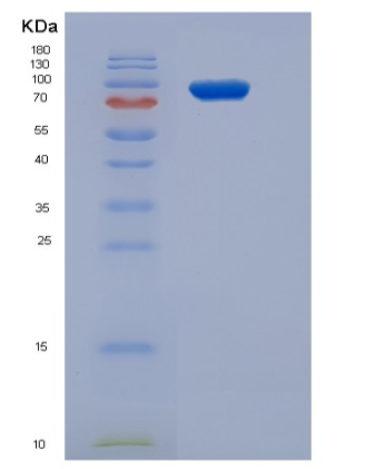 Recombinant Human STK23 / MSSK1 / SRPK3 Protein (His & GST tag)