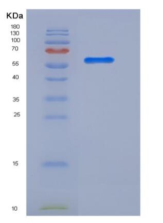 Recombinant Human LRG1 Protein (Fc tag)