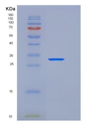 Recombinant Mouse sFRP2 Protein (His tag)