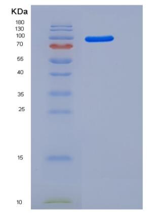Recombinant Mouse AGO2 / Argonaute 2 / EIF2C2 Protein (His tag)
