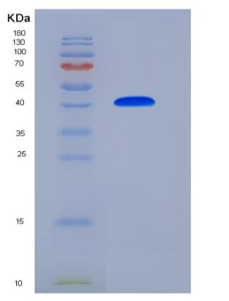 Recombinant Human NBL1 / DAND1 / DAN Protein (Fc tag)