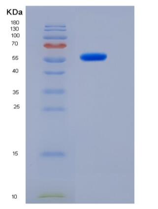 Recombinant Human ALDH1A3 / RALDH3 Protein (His tag)