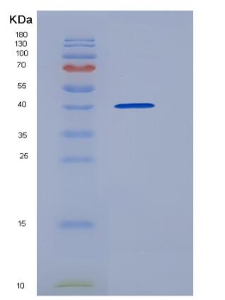 Recombinant Mouse BAMBI / NMA Protein (Fc tag)