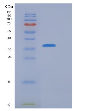 Recombinant Human CFHR1 Protein (His Tag)