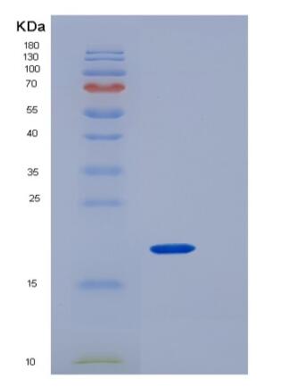 Recombinant Human CD4 / LEU3 Protein (aa 1-208, His tag)