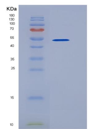 Recombinant Human CD96 Protein (His tag)