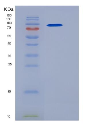 Recombinant Mouse LDLR / LDL Receptor Protein (His tag)