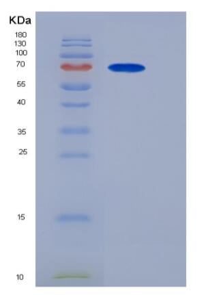 Recombinant Mouse PCSK9 / NARC1 Protein (His tag)