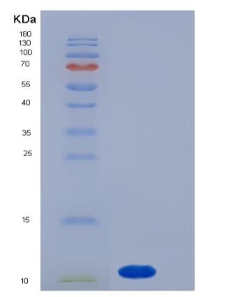 Recombinant Human S100A7 / PSOR1 Protein