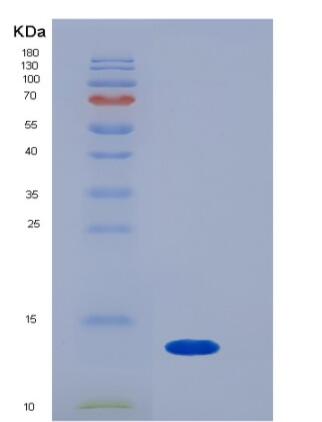 Recombinant Rat B2M / Beta-2-microglobulin Protein (His tag)