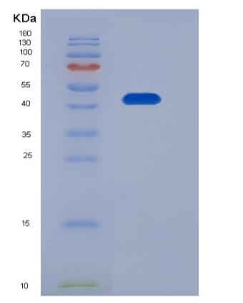 Recombinant Human FDPS Protein (His tag)