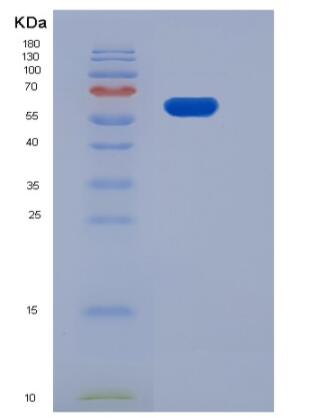 Recombinant Human EphB1 / EPHT2 Protein (His tag)