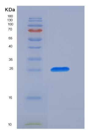 Recombinant Human CD89 / FCAR Protein (His tag)