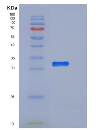 Recombinant Mouse UCHL3 / UCH-L3 Protein (His tag)