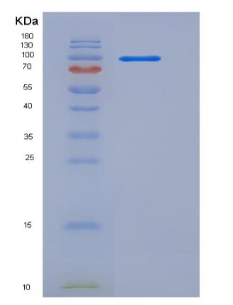 Recombinant Human C2 / Complement Component 2 Protein (Fc tag)