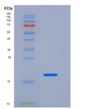 Recombinant Rat FAS / CD95 / APO-1 / TNFRSF6 Protein (His tag)