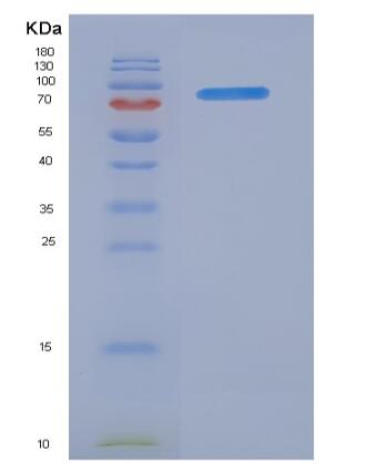 Recombinant Human FAP / Seprase Protein (His tag)
