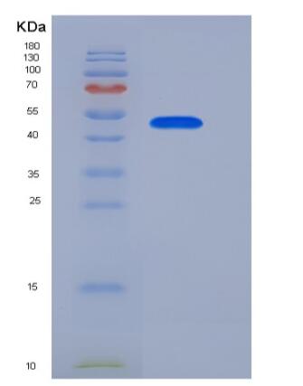 Recombinant Human NTPDase 2 / ENTPD2 Protein (aa 29-460, His tag)