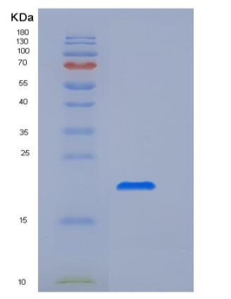 Recombinant Human Fc γ RIIa/FCGR2A/CD32a Protein(C-6His,H131)