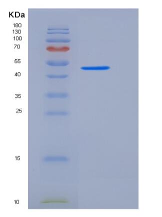 Recombinant Human CD200 / OX-2 Protein (His & Fc tag)