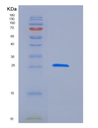 Recombinant Human Latexin / LXN / TCI Protein (His tag)