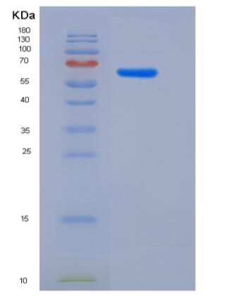 Recombinant Rat Galectin-8 / LGALS8 Protein (GST tag)