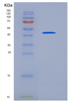 Recombinant Mouse ACY1 / Aminoacylase-1 Protein (His tag)