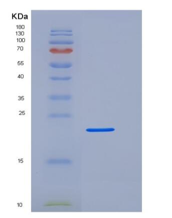 Recombinant Human Fc γ RIIIA/FCGR3A/CD16a Protein(C-6His,Val176Phe)