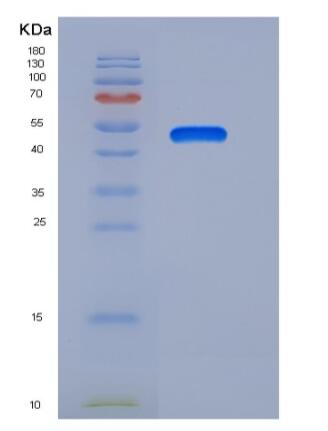 Recombinant Human Latexin / LXN / TCI Protein (Fc tag)
