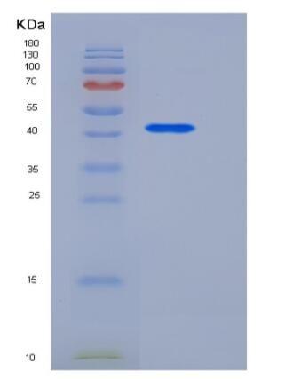 Recombinant Human DDR2 Kinase / CD167b Protein (Fc tag)