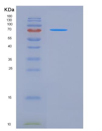 Recombinant Mouse E-Cadherin / CDH1 / E-cad / CD324 Protein (His tag)