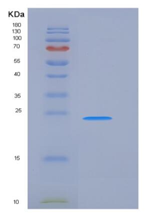Recombinant Human FcERI / FCER1A Protein (His tag)