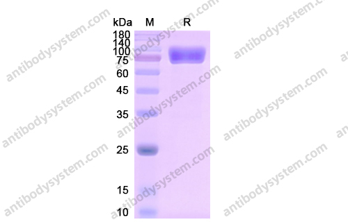 Recombinant Human CD121a/IL1R1, C-Fc