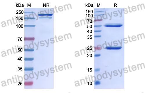 Anti-DOTA (metal-bound) Antibody (2D12.5) (RGN38301)